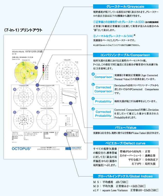 プリントアウト