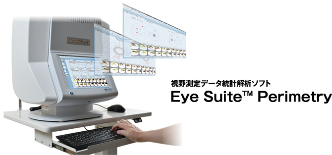 視野測定データ統計解析ソフトEye Suite™ Perimetry